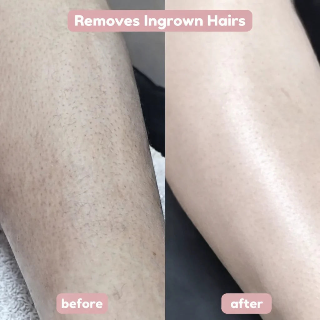 Seidenglanz™ | 2-In-1 Women'S Razor for Smooth and Well-Groomed Skin